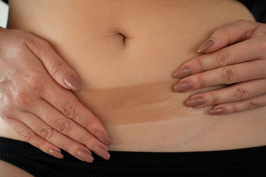 Close-up of a person's hands on their stomach, with a yung bod scar strip