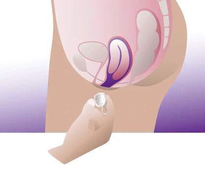 Cube pessary before insertion